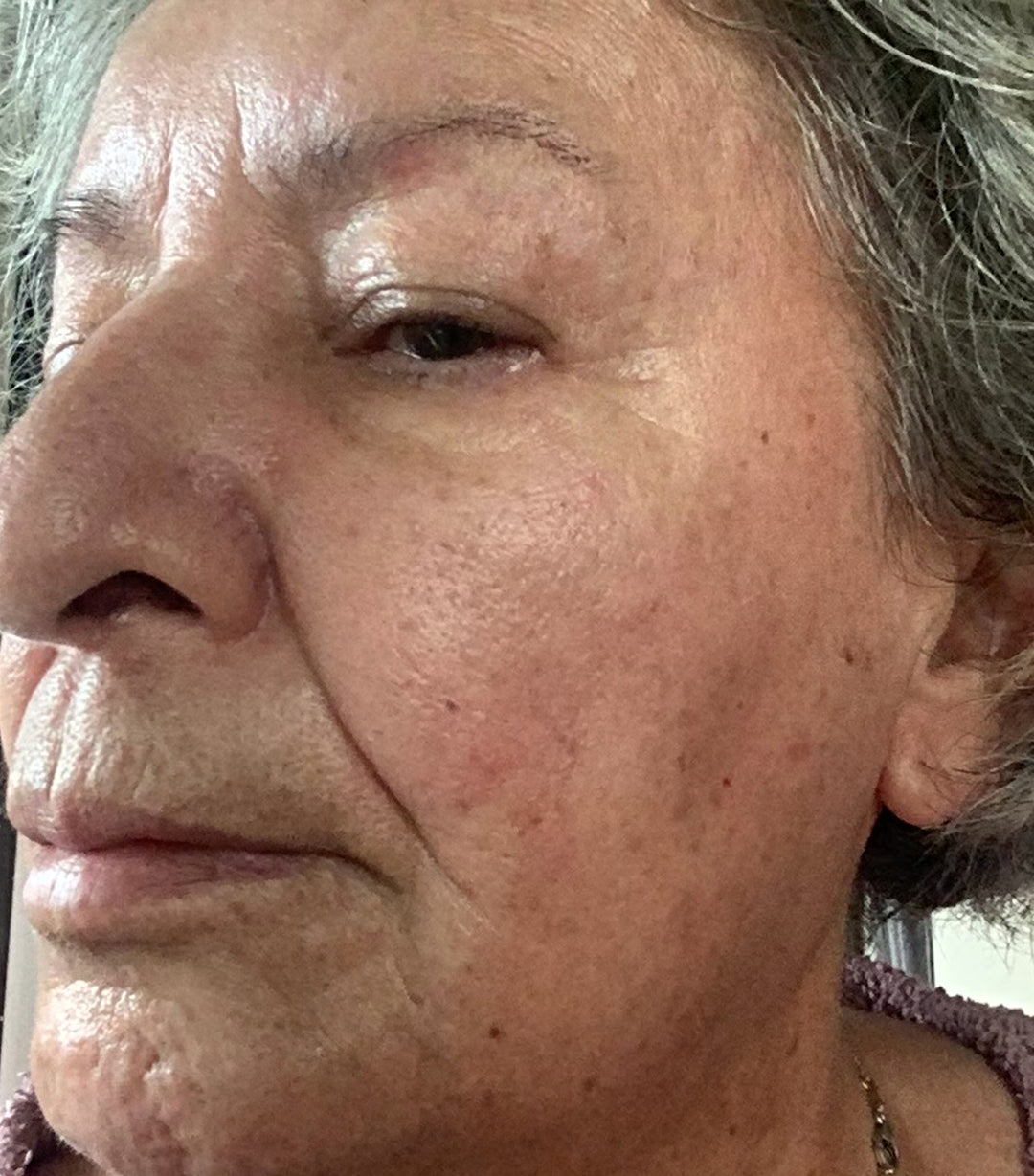 Sylvia at week 8 of the study, after using Prep