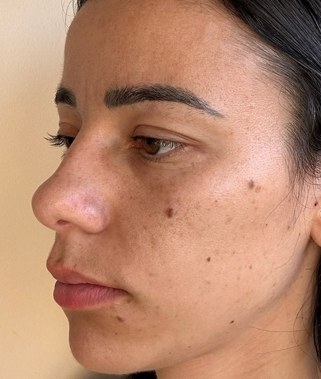 Study participant at week 8, after using The Edit